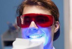 Tẩy trắng răng bằng đèn plasma