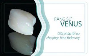 Bọc răng sứ venus giá bao nhiêu?