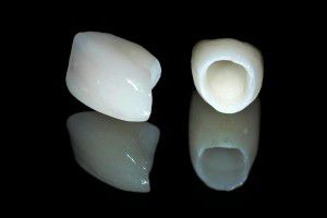Răng sứ không kim loại Ziconia Venus