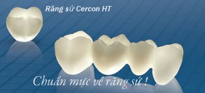 Răng sứ Cercon HT thay thế hoàn hảo cho răng thật