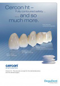 Răng sứ cercon ht là gì?