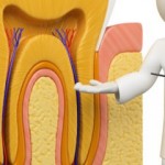 Điều trị tủy răng bằng máy vi phẫu hiện đại