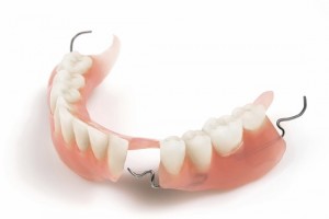 Giải pháp cho những người bị mất nhiều răng