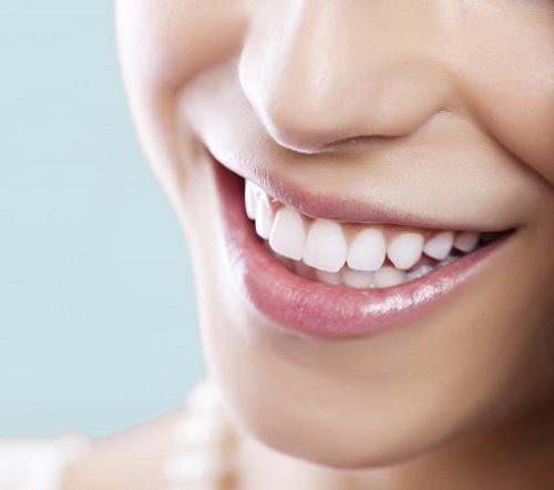 Tác hại của việc tẩy trắng răng gây ảnh hưởng gì cho bạn 3
