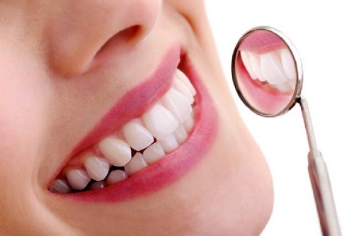 Răng sứ titan có mấy loại? Loại nào tốt nhất?-3