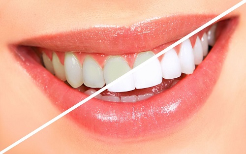 Cách làm trắng răng bằng cà chua cho bạn 1