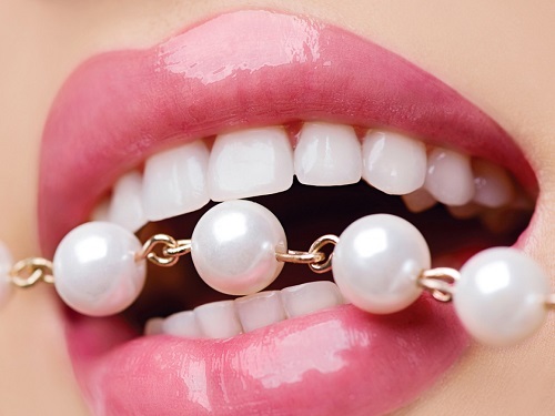 Tẩy trắng răng plasma có hại không? Tư vấn chuyên sâu 1