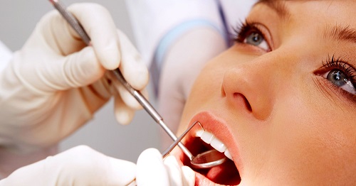 Lấy cao răng có đau hay không? Tìm hiểu cách giảm thiểu cao răng 2