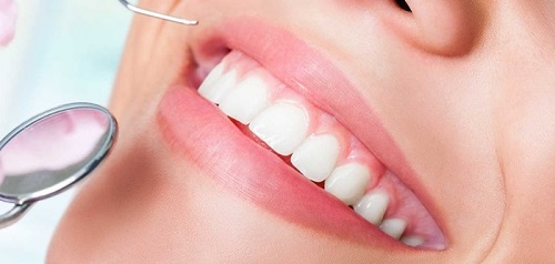 Nên lựa chọn làm răng tại nha khoa uy tín*