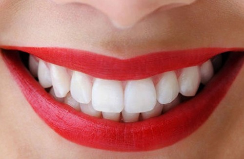Bọc răng hàm bị sâu có đau không? Nha khoa giải đáp 1