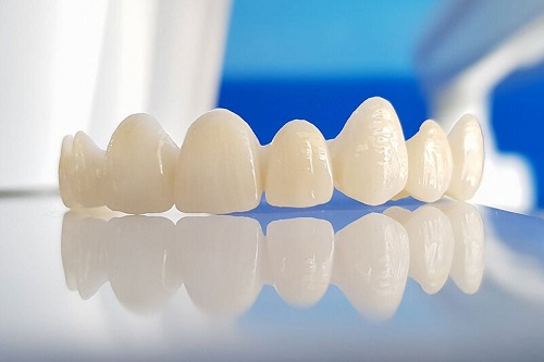 Bọc răng sứ có tác hại gì không? Lời khuyên từ nha khoa 2