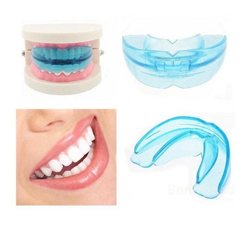 Dụng cụ niềng răng tại nhà 3 giai đoạn cho bạn 2